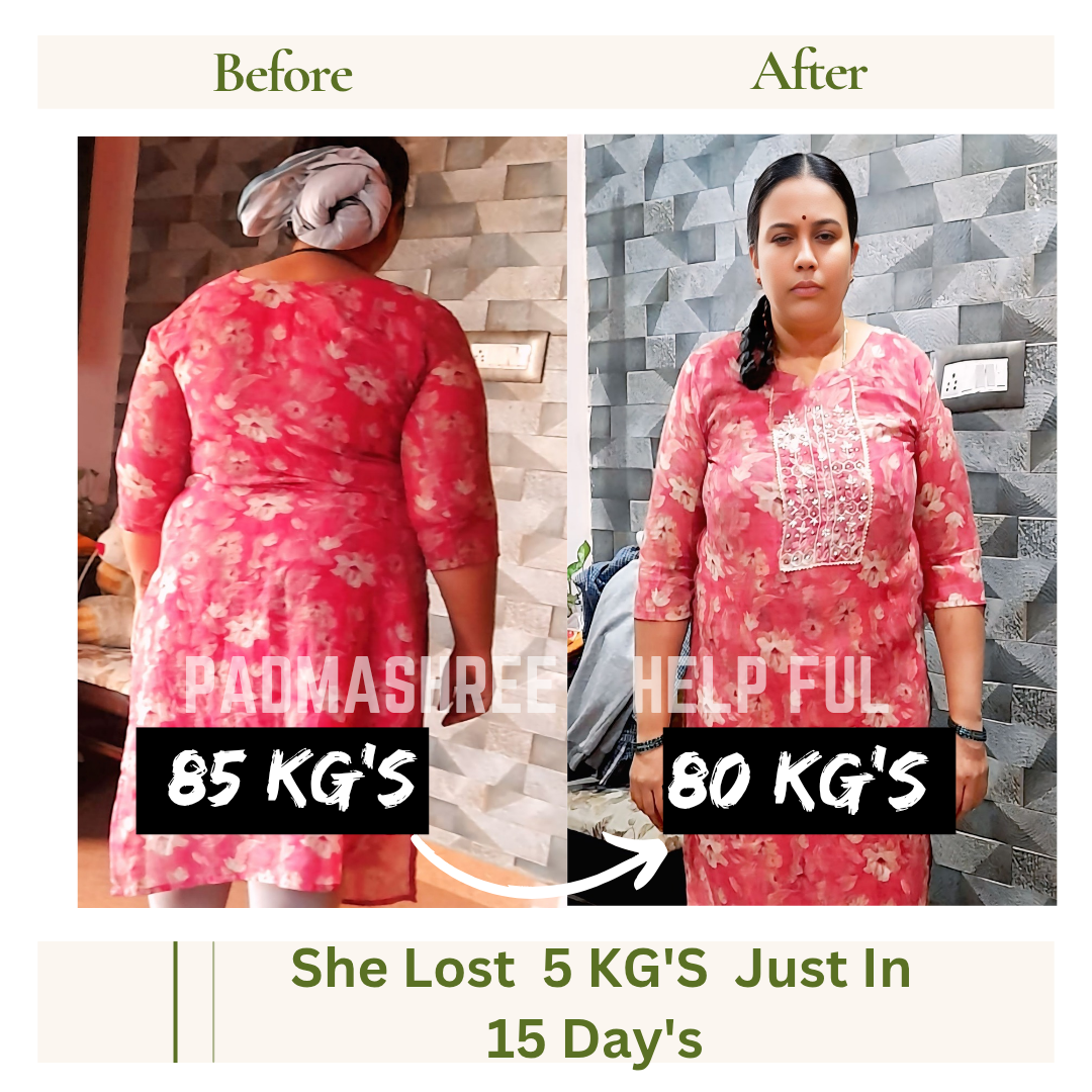 Weight loss transformation - 5 KGs lost in 15 days